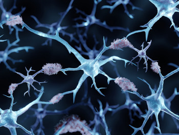Understanding neurodegenerative diseases